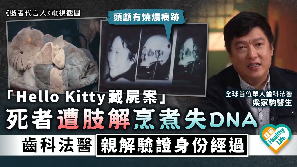 逝者代言人︳「Hello Kitty藏屍案」死者遭肢解烹煮失DNA 齒科法醫親解驗證身份經過