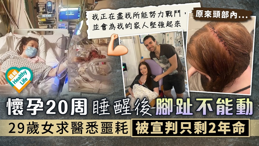 媽媽最痛︳懷孕20周睡醒後腳趾不能動 29歲女求醫悉噩耗被宣判只剩2年命
