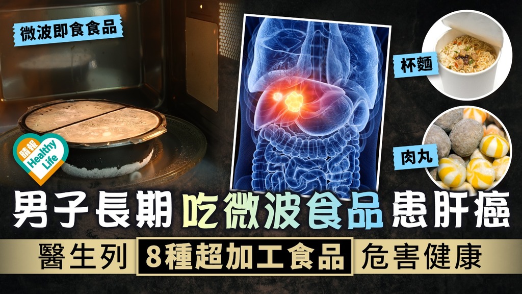 加熱即食陷阱︳男子長期吃微波食品患肝癌 醫生列8種超加工食品危害健康