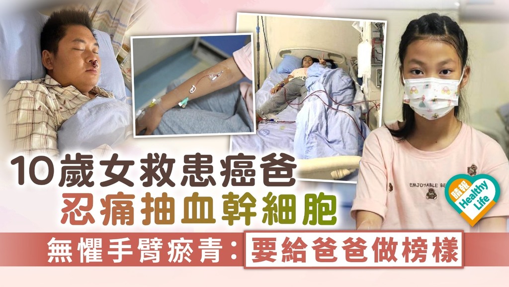 父親節｜10歲女救患淋巴癌爸忍痛抽血幹細胞 無懼手臂瘀青：要給爸爸做榜樣