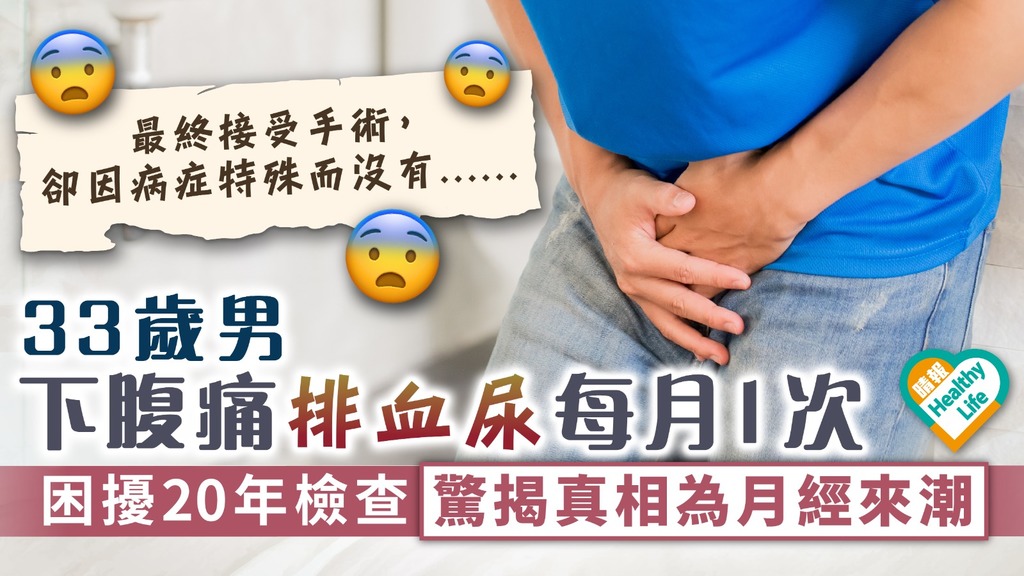 罕見病症︳33歲男下腹痛排血尿每月1次 困擾20年檢查驚揭真相為月經來潮
