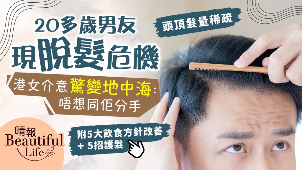 Beautiful Life︳20多歲男友現脫髮危機 港女介意驚變地中海：唔想同佢分手︳附改善方法