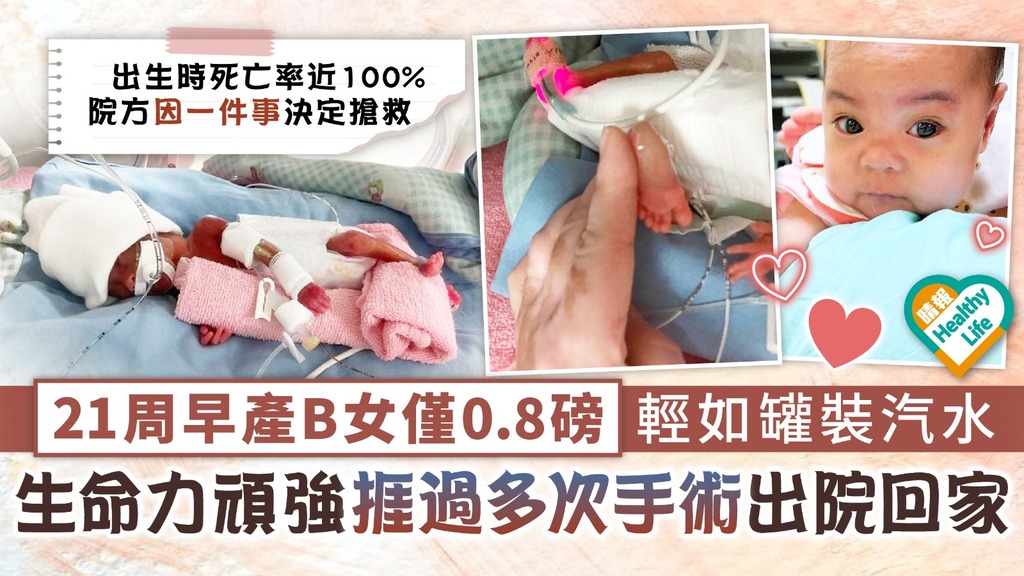 生命鬥士︳21周早產B女僅0.8磅輕如罐裝汽水 生命力頑強捱過多次手術出院回家