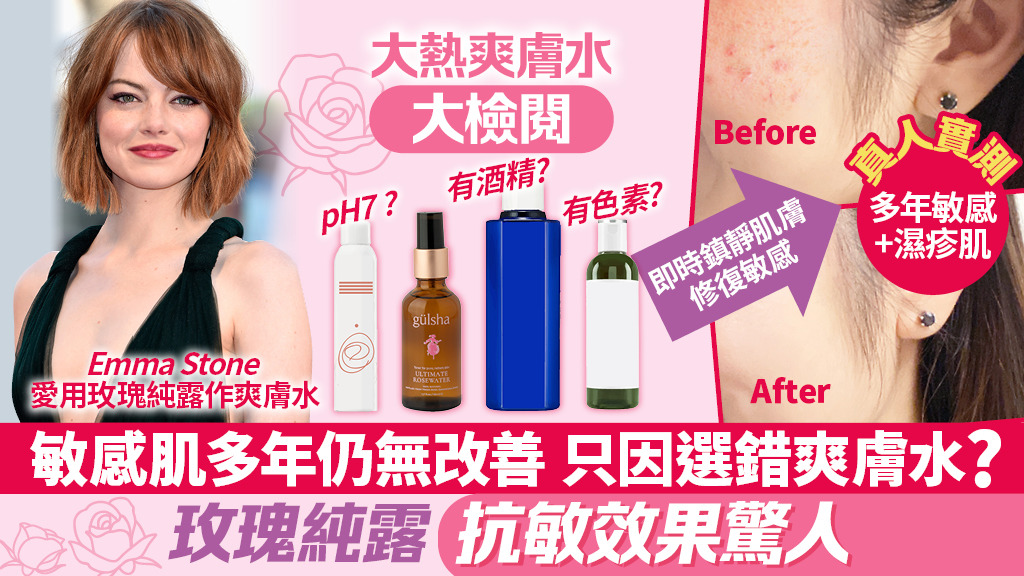 真人實測！修復多年敏感肌 連Emma Stone都大推「玫瑰純露」！