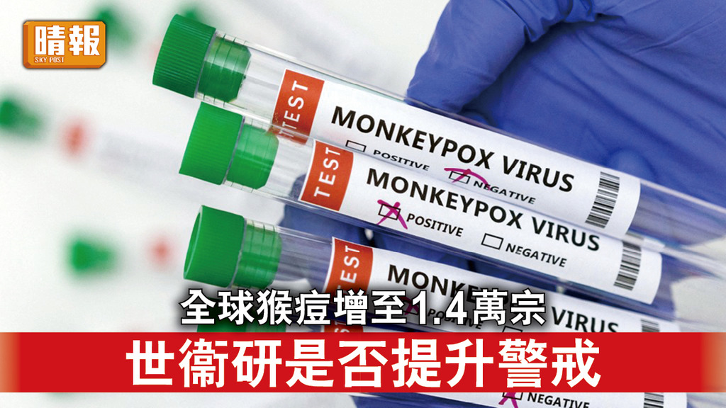 猴痘｜世衞指全球猴痘增至1.4萬宗 將再開會討論是否提升警戒