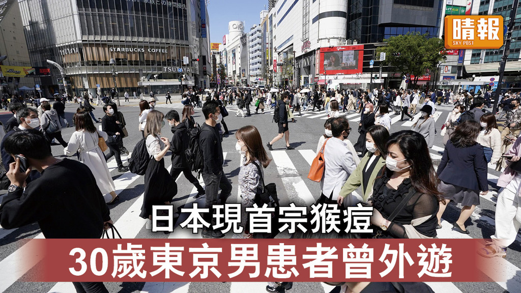 猴痘｜日本現首宗猴痘 30歲東京男患者曾外遊