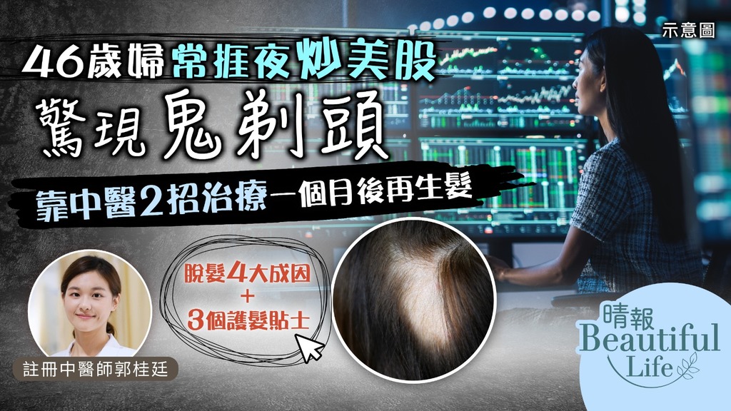Beautiful Life．斑禿︳46歲婦常捱夜炒美股驚現鬼剃頭 靠中醫2招治療一個月後再生髮︳附脫髮4大成因＋3個護髮貼士