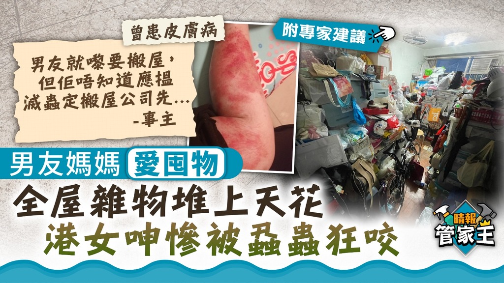 管家王 ︳男友媽媽愛囤物堆上天花 港女呻慘被蝨蟲狂咬【附專家建議】