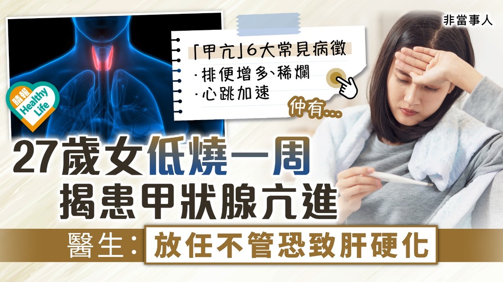 甲狀腺亢進︳27歲女低燒一周揭患甲狀腺亢進 無典型症狀易忽視 醫生：放任不管恐致肝硬化︳附6大病徵