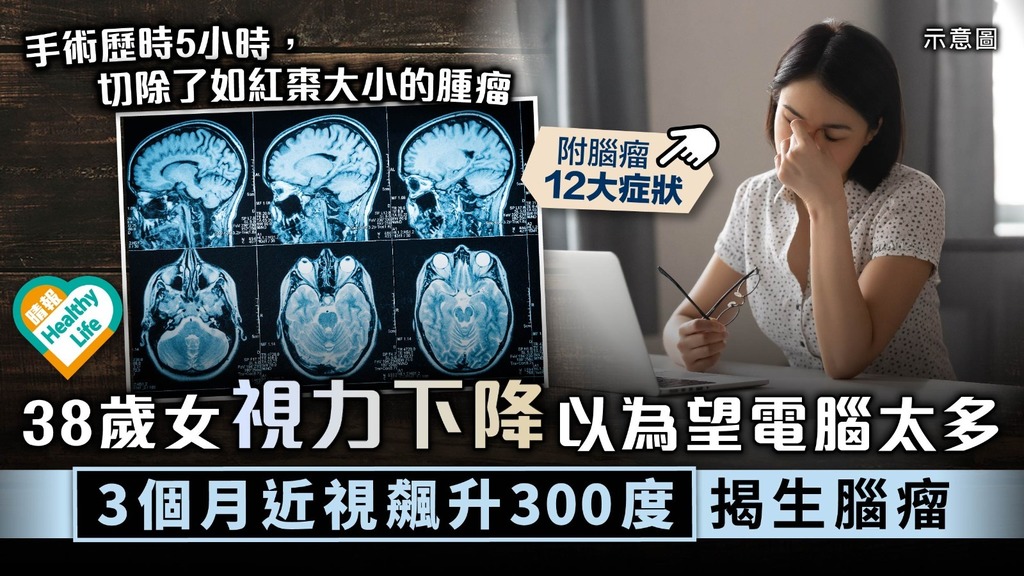 腦腫瘤︳38歲女視力下降以為望電腦太多 3個月近視飆升300度揭生腦瘤︳附腦瘤12大症狀
