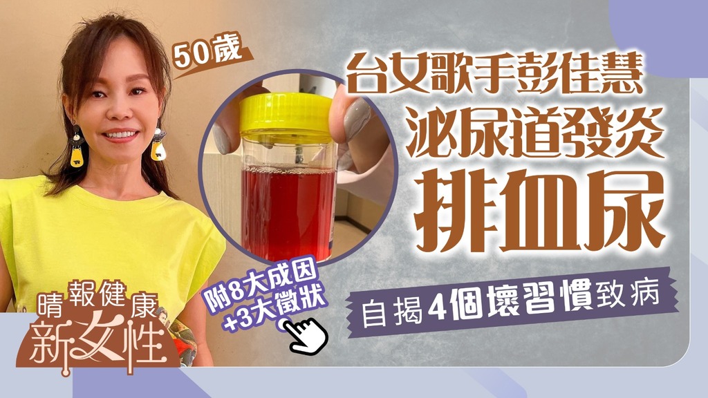 健康新女性︳50歲台女歌手彭佳慧泌尿道發炎排血尿 自揭4個壞習慣致病 ︳拆解8大成因