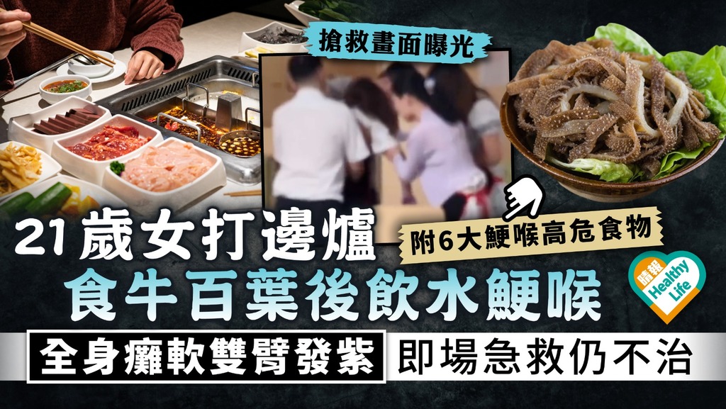 危險動作︳21歲女打邊爐食牛百葉後飲水鯁喉 手臂發紫員工急救仍回天乏術 ︳附6大鯁喉高危食物