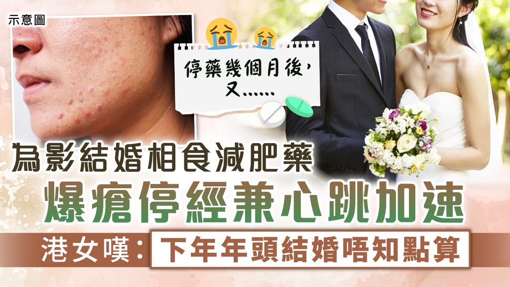 減肥瘦身︳為影結婚相食減肥藥現副作用 爆瘡停經兼心跳加速 港女嘆：下年年頭結婚唔知點算