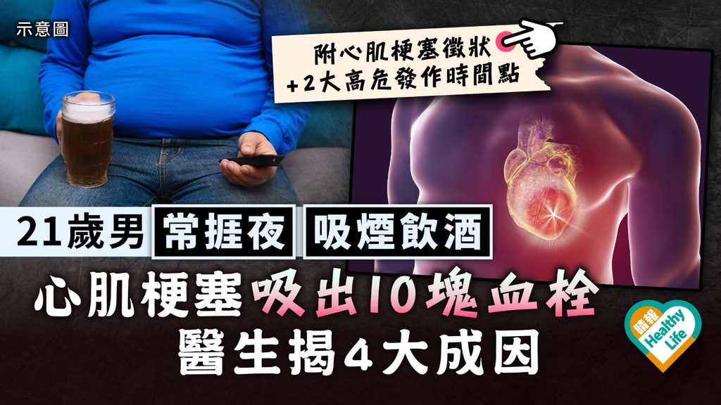 心臟健康︳21歲男常捱夜吸煙飲酒 心肌梗塞吸出10塊血栓 醫生揭4大成因