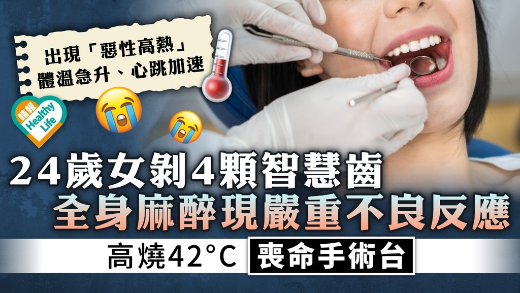 剝牙悲劇︳24歲女剝4顆智慧齒 全身麻醉現嚴重不良反應 高燒42°C喪命手術台