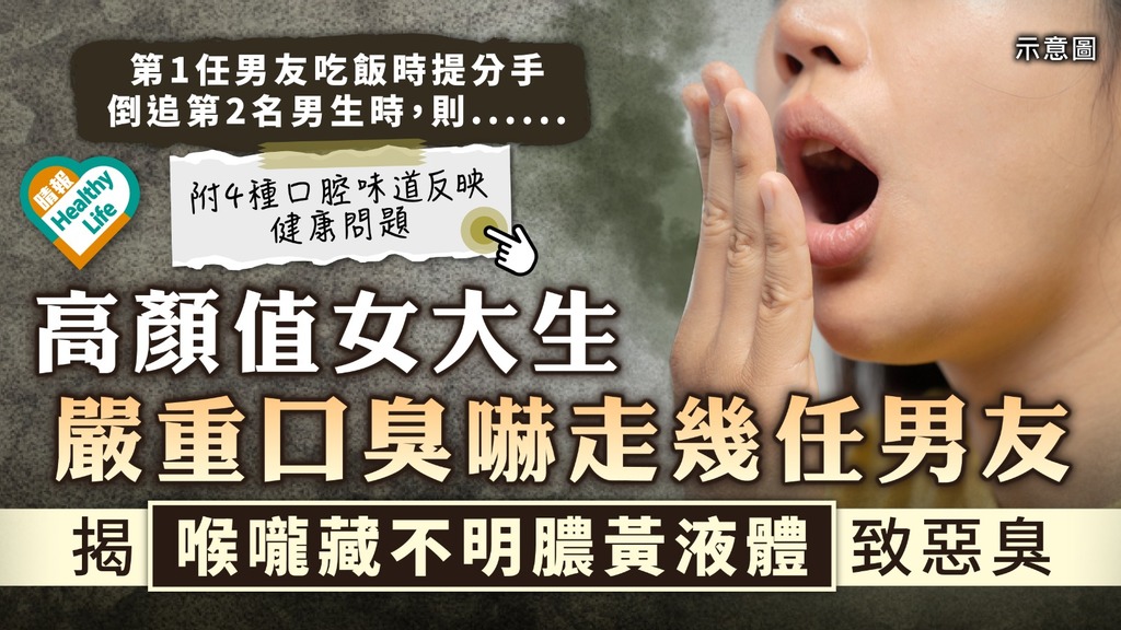 口臭問題︳高顏值女大生嚴重口臭嚇走幾任男友 求醫揭喉嚨藏不明膿黃液體致惡臭