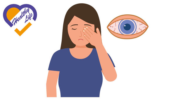 疫下延誤檢查 眼疾惡化恐失明 8成人眼睛乾痕倦響警號