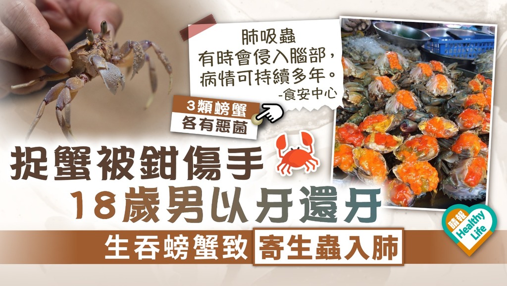 食用安全 ︳捉蟹被鉗傷手18歲男以牙還牙 生吞螃蟹致寄生蟲入肺
