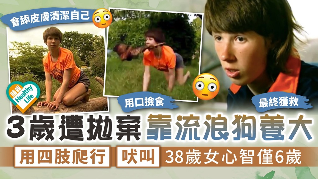 痛心不已︳3歲遭拋棄靠流浪狗養大 用四肢爬行吠叫 38歲女心智僅6歲