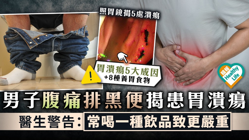 飲食習慣︳男子腹痛排黑便揭患胃潰瘍 醫生警告：常喝一種飲品致更嚴重