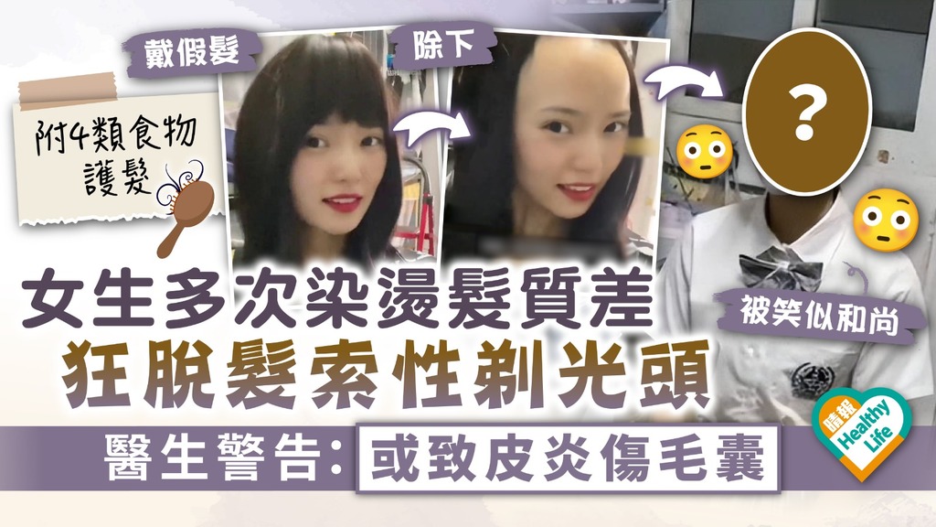 得不償失?︳女大生多次染燙髮質差 狂脫髮索性剃光頭 醫生警告：或致皮炎傷毛囊︳附4類食物護髮