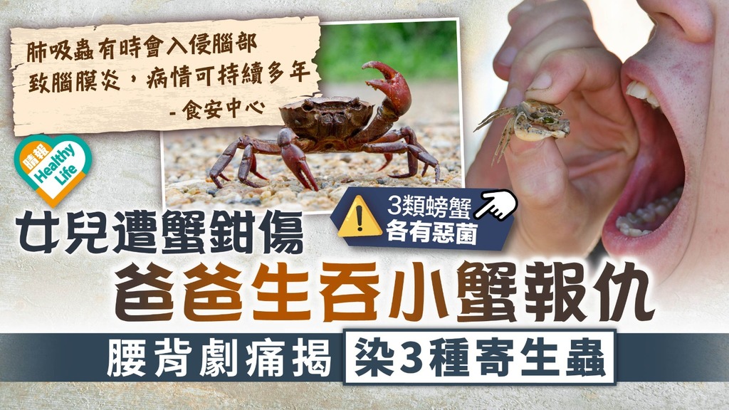 食用安全︳女兒遭蟹鉗傷 爸爸生吞小蟹報仇 腰背劇痛揭染3種寄生蟲︳附螃蟹常見寄生蟲及細菌