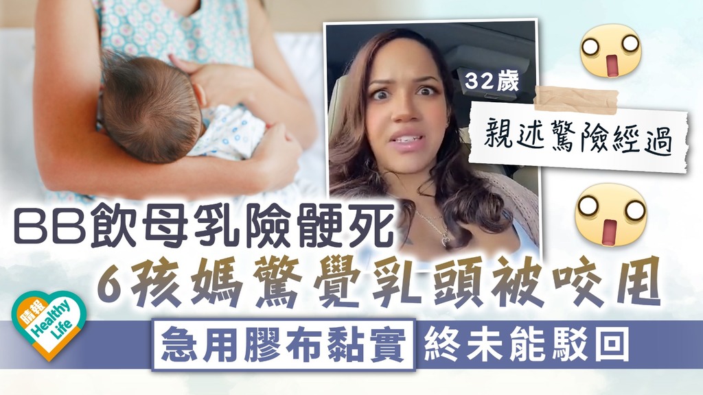 媽媽唔易做︳BB飲母乳險骾死 6孩媽驚覺乳頭被咬甩 急用膠布黏實終未能駁回