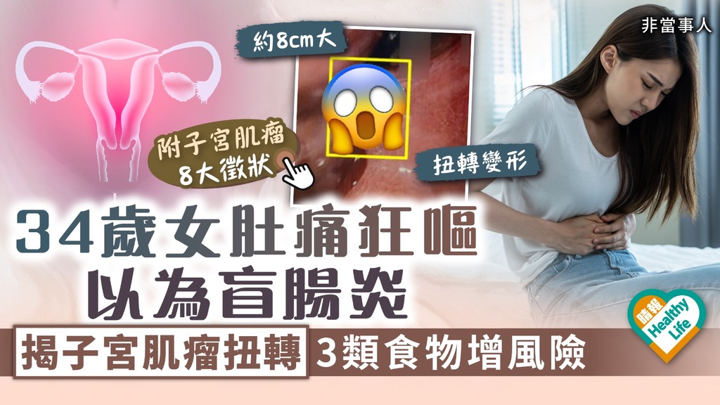 女士注意︳34歲女肚痛狂嘔以為盲腸炎 揭子宮肌瘤扭轉 婦科醫生警告：3類食物增風險︳附8大徵狀