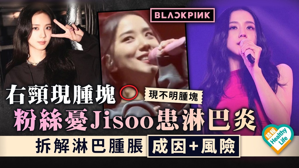 BLACKPINK ︳右頸現腫塊粉絲憂Jisoo患淋巴炎 拆解淋巴腫脹成因+風險