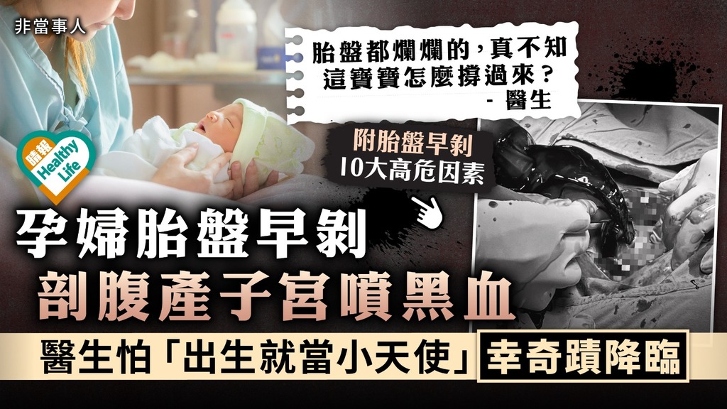 生育之苦︳孕婦胎盤早剝 剖腹產子宮噴黑血 醫生怕「出生就當小天使」幸奇蹟降臨
