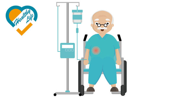 一二綫標靶藥接力治療 晚期肝癌延存活