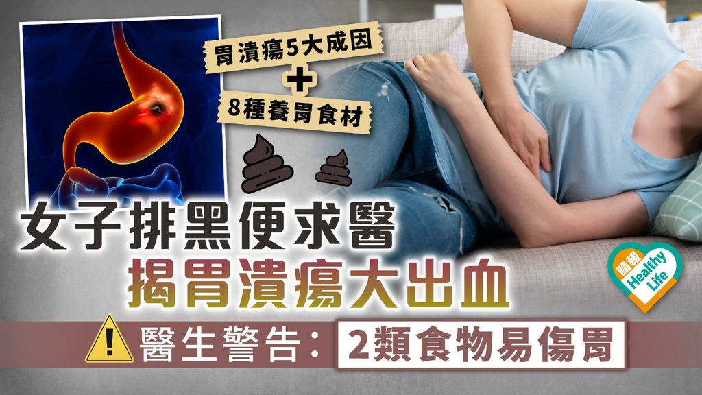 胃潰瘍︳女子排黑便求醫 揭胃潰瘍大出血 醫生警告：2類食物易傷胃