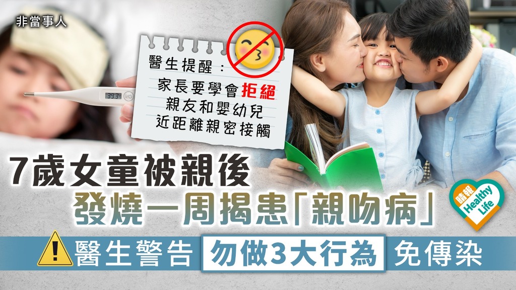 EB病毒︳7歲女童被親後發燒一周不退 求醫揭患「親吻病」 醫生警告勿做3大行為免傳染