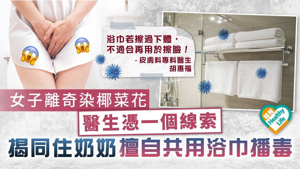 恐怖奶奶︳女子離奇染椰菜花 醫生憑一個線索 揭同住奶奶擅自共用浴巾播毒