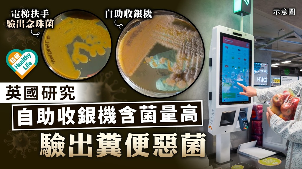 暗藏惡菌 ︳英國研究：自助收銀機含菌量高 驗出糞便惡菌