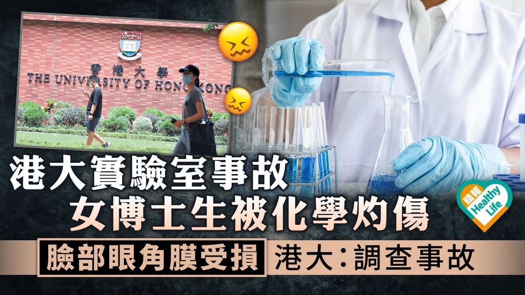 港大實驗室事故︳女博士生被化學灼傷 臉部眼角膜受損 港大：調查事故 