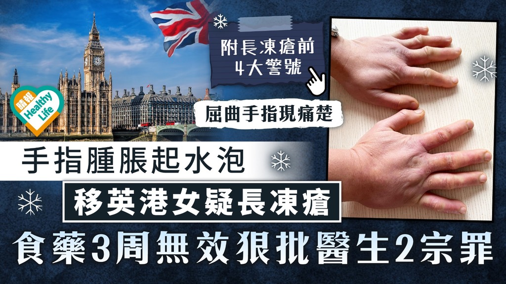 寒冷天氣︳手指腫脹起水泡 移英港女疑長凍瘡 食藥3周無效狠批醫生2宗罪