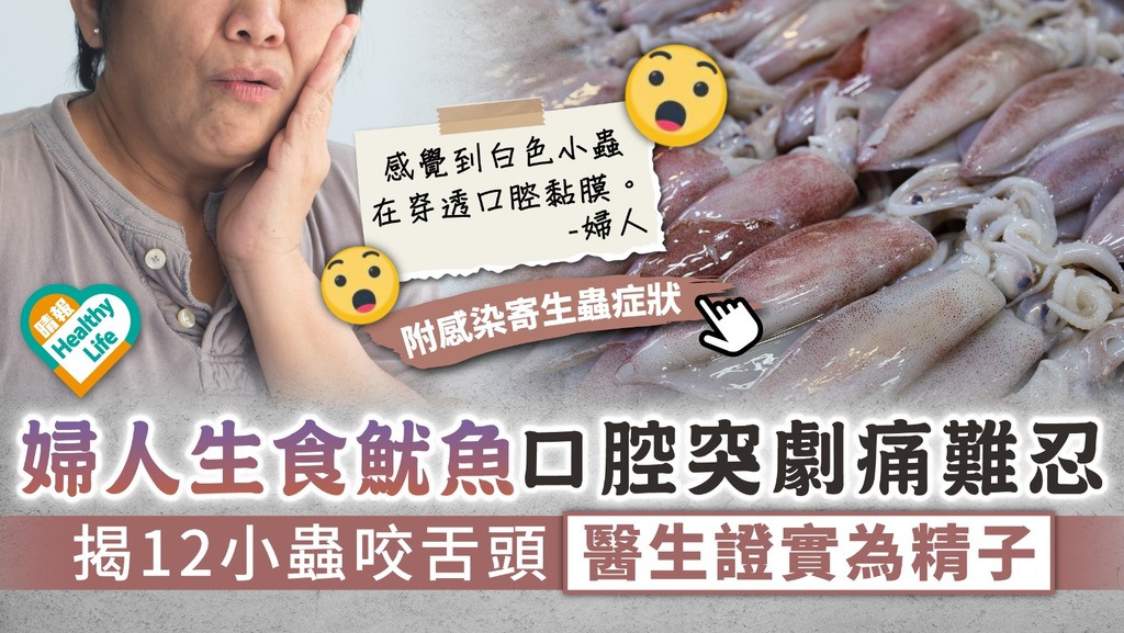 食用安全︳婦人生食魷魚口腔突劇痛難忍 揭12小蟲咬舌頭 醫生證實為精子︳附感染寄生蟲症狀