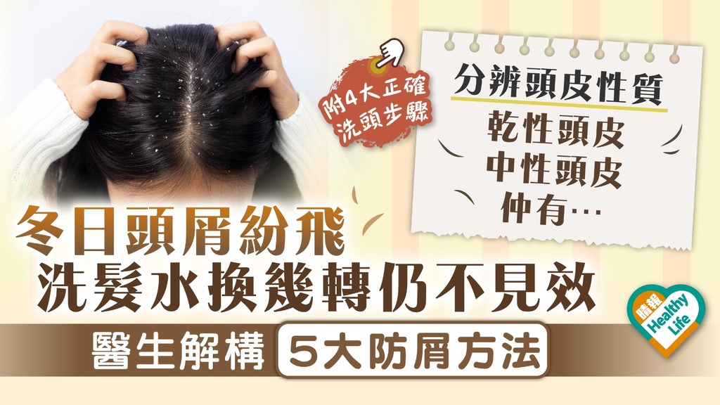 雪花紛飛｜ 冬日頭屑紛飛 洗髮水換幾轉仍不見效 醫生解構5大防屑方法
