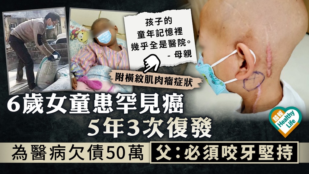 兒童癌症︳6歲女童患罕見癌5年3次‎復發 為醫病欠債50萬 父：必須咬牙堅持︳附橫紋肌肉瘤症狀
