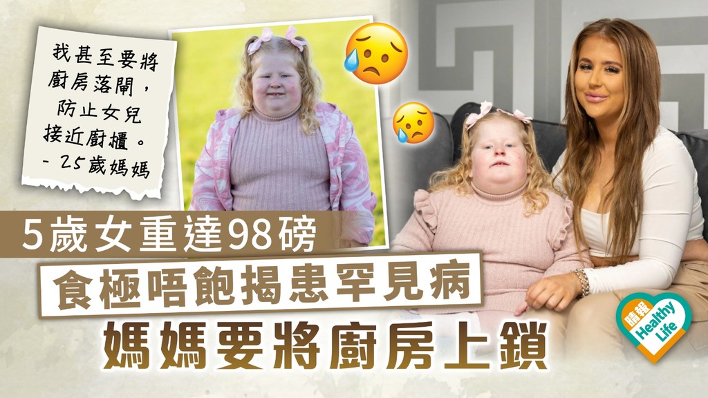 罕見病｜5歲女重達98磅 食極唔飽揭患罕見病 媽媽要將廚房上鎖