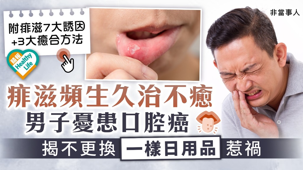 口腔健康 ︳痱滋頻生久治不癒 男子憂患口腔癌 揭不更換一樣日用品惹禍