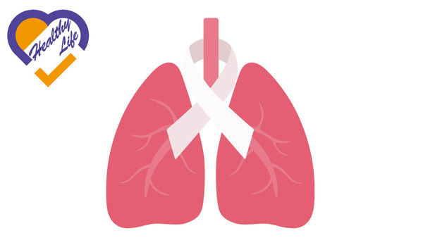 術後輔助免疫治療 肺癌減復發延存活