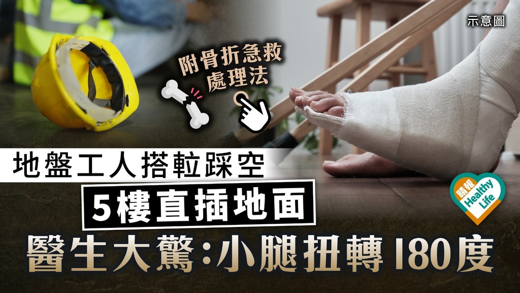 工業意外｜地盤工人搭𨋢踩空 5樓直插地面 醫生大驚：小腿扭轉180度