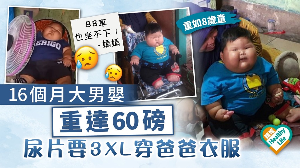 重磅巨嬰｜16個月大男嬰重達60磅 尿片要3XL穿爸爸衣服