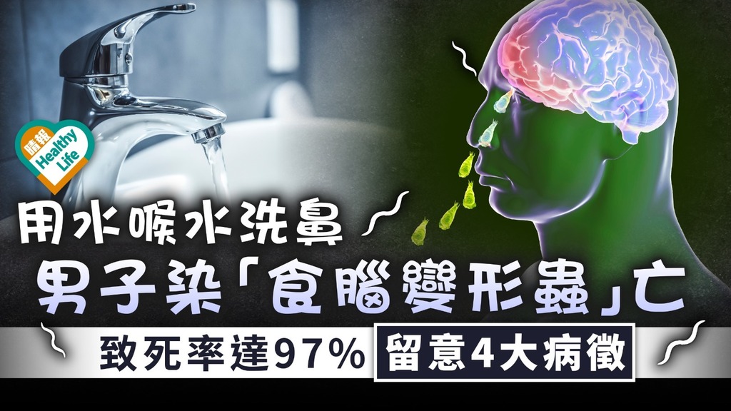洗鼻危機｜男子用水喉水洗鼻染「食腦變形蟲」亡 致死率達97%留意4大病徵