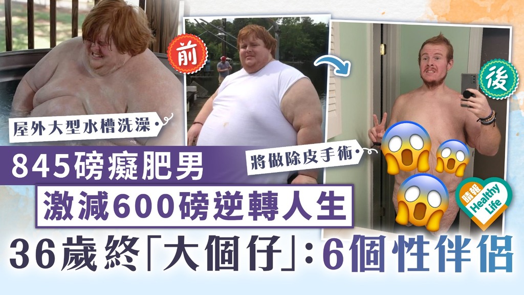 減肥瘦身︳845磅癡肥男激減600磅逆轉人生 36歲終「大個仔」：6個性伴侶