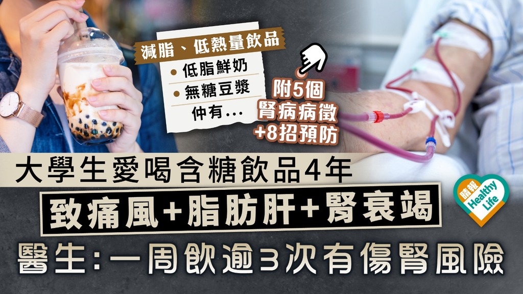 注意飲食︳大學生愛喝含糖飲品4年 致痛風+脂肪肝+腎衰竭 醫生警告：一周逾3次有傷腎風險