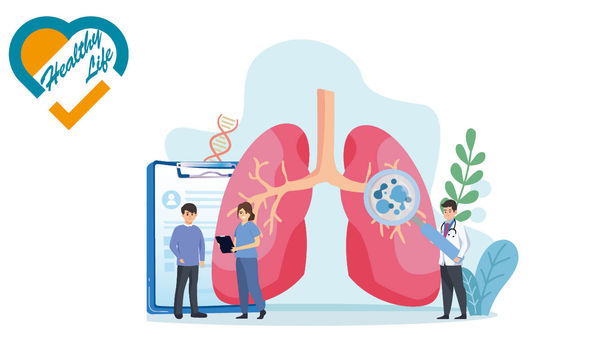 熱綫+網上平台 助掌資訊早治療 組織「導航」支援肺癌患者