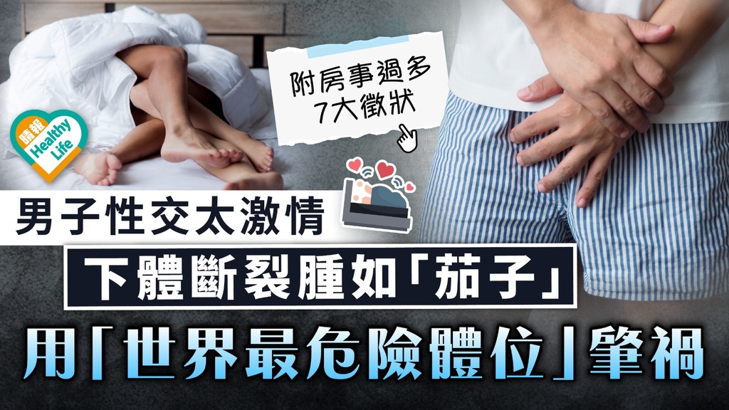 男士健康｜男子性交太激情 下體斷裂腫如「茄子」 用「世界最危險體位」肇禍 
